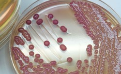 Rekordowa liczba ognisk zakażeń szpitalnych. Które bakterie najgroźniejsze?