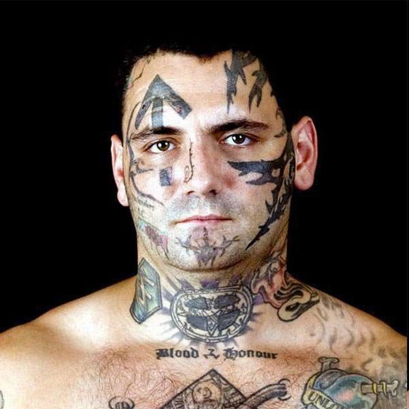 Tak neonazista usunął sobie tatuaże z twarzy! Zobacz