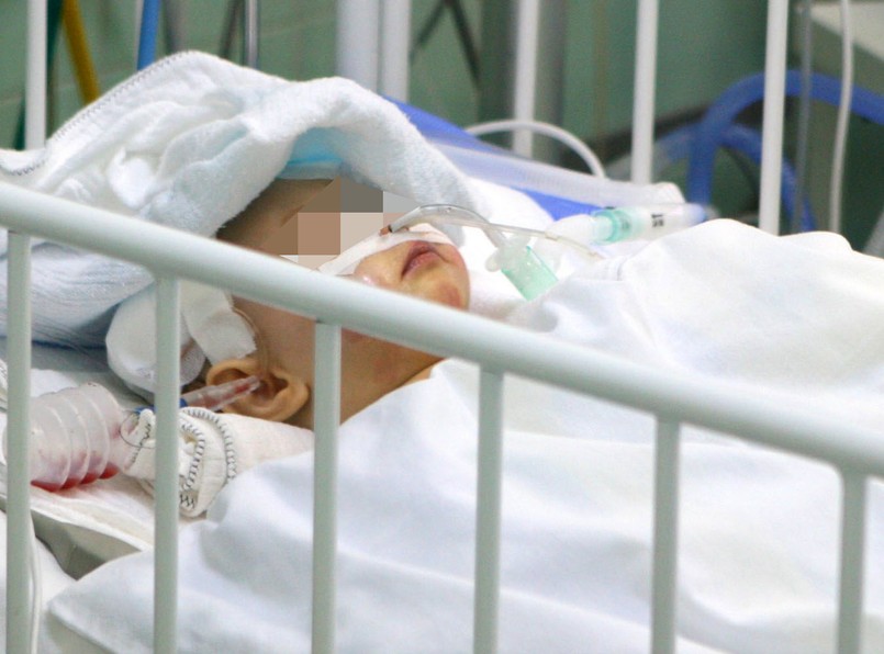 Zaatakowana przez psa dziewczynka walczy o życie