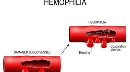 Chorzy na hemofilię chcą być leczeni bezpiecznie
