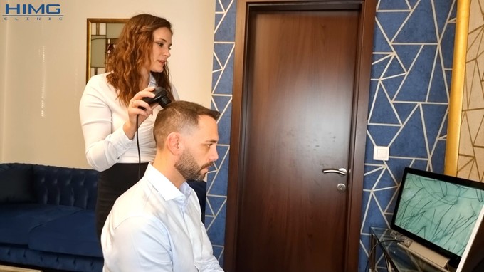 Mikor lesz látható a végleges eredmény a hajbeültetés után?
