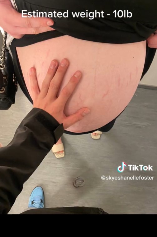 Fotky z videa Skye Shanelle Fosterovej.