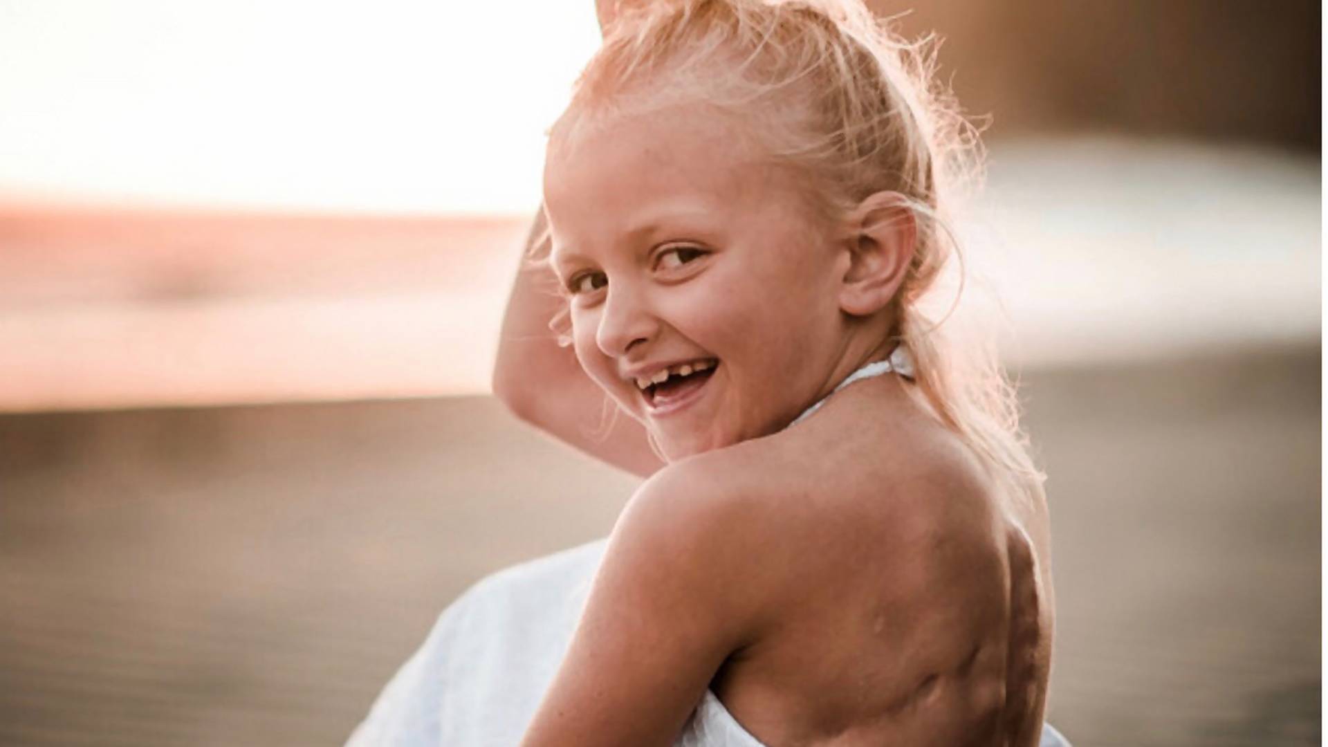 9-latka usłyszała, że powinna ukryć swoje "przerażające" blizny po walce z rakiem. Jej mama publikuje piękny przekaz