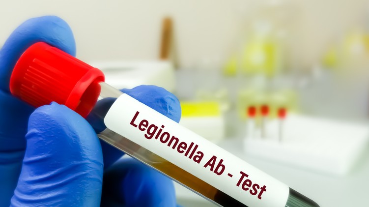 Legionárius betegség, legionellosis oka tönet kezelés
