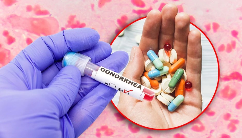 Antibiotici mogu i da unaprede preživljavanje bakterija