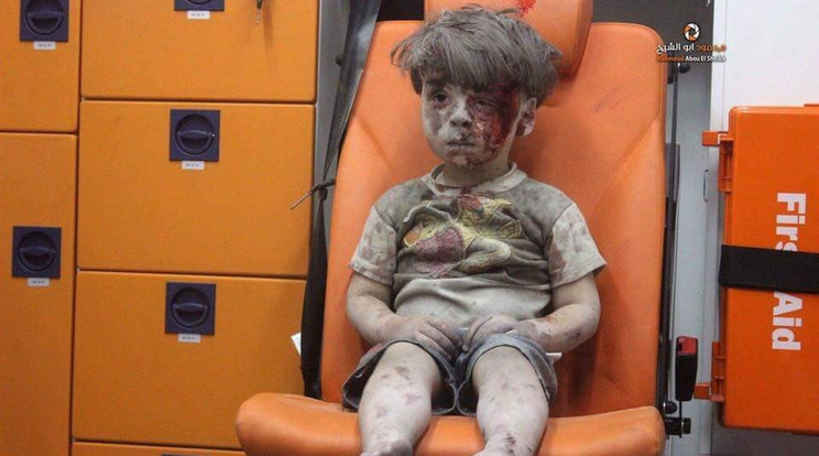 Az öt éves Omran képe bejárta a világot