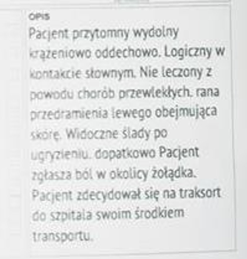 Mieszkaniec Milanówka został ugryziony przez Jolantę Turczynowicz-Kieryłło