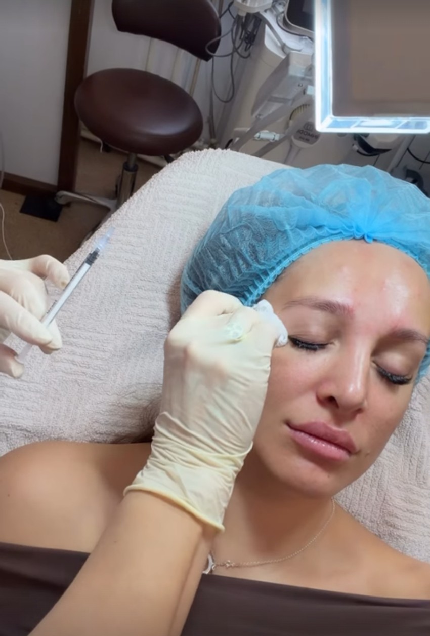 Luna Đogani ubrizgava botoks u lice, snimala se tokom tretmana