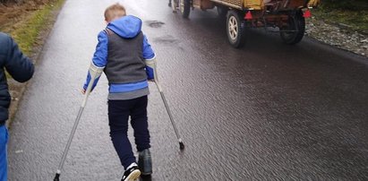 Chłopiec o kulach zawstydził turystów. Jest niesamowity