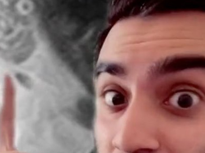 Lekar sa MRI snimkom