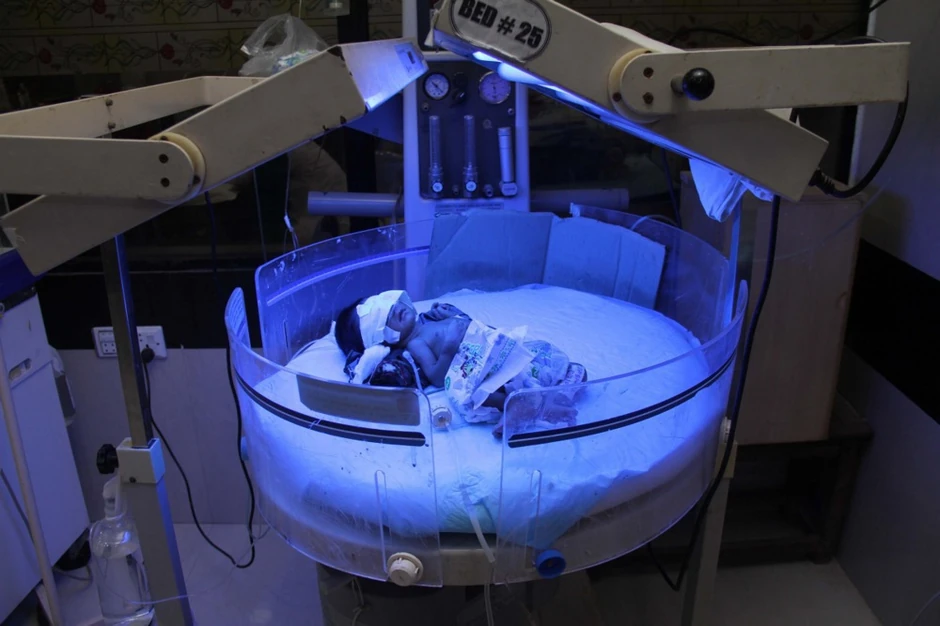 Beba obolela od tifusa otpornog na lekove u bolnici u Hajderabadu u Pakistanu (arhiva)