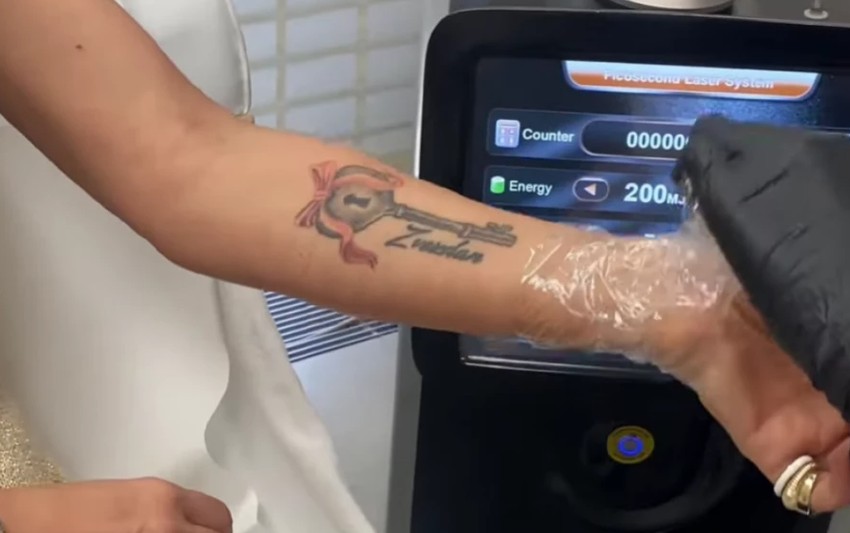 Ana Ćurčić uklonila tetovažu koju je posvetila Zvezdanu Slavniću