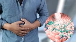 Suena asqueroso, podría ser una cura para la obesidad y el cáncer.  ¿Qué es un trasplante de bacterias intestinales?