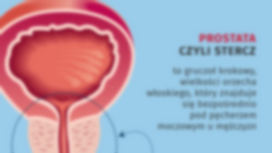 Prostata - co musisz o niej wiedzieć, a boisz się zapytać? [INFOGRAFIKA]