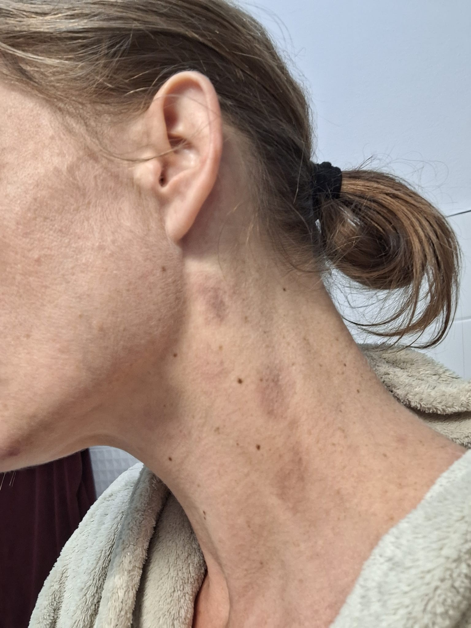 Katarína Šimurka Feldeková natáča seriál, v ktorom hrá týranú ženu.