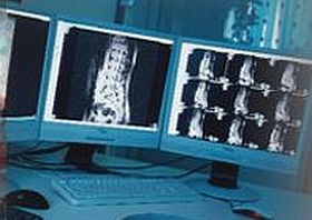 gerinc-mri-d0000127B92928b5b475d