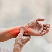 Rheumatoid artritisz: ez is okozhatja a reggeli ízületi merevséget
