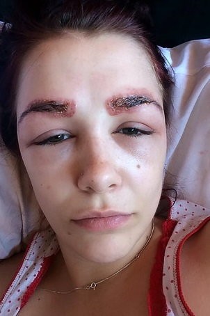 19-latka chciała mieć pełniejsze brwi. Jak to się ...