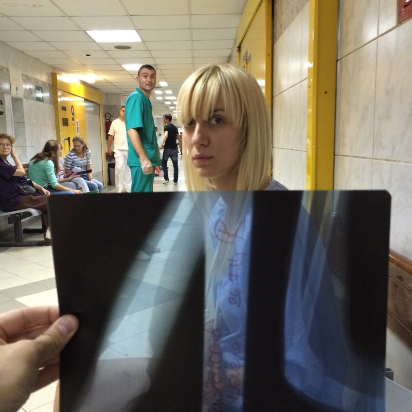 Pala sa bicikla: Nevena u Urgentnom centru