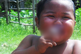 Evo šta se desilo sa dečakom koji je SA 2 GODINE PUŠIO 40 CIGARETA DNEVNO! Pio 3 litra mleka na dan, prejedao se i bio na ivici SMRTI - otac ga uveo u porok, majka strahovala da će umreti