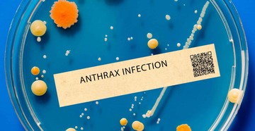 Anthrax (lépfene): tünetei, vizsgálata és a kezelési lehetőségei