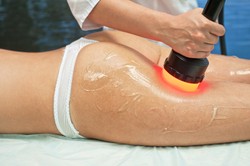 Wiara czyni cuda? Oto, co robią Polki, by pozbyć się cellulitu