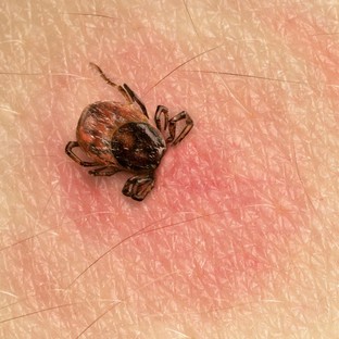 A Lyme-kór kezelése után is jelentkeznek tünetek? Ez lehet az oka!