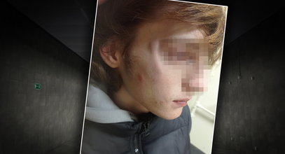Wstrząsające! Nastolatek został brutalnie pobity, bo... rozmawiał ze swoim kolegą