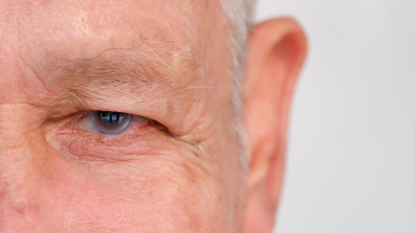 homályos látás szemfájdalom oka zöldhályog tünet