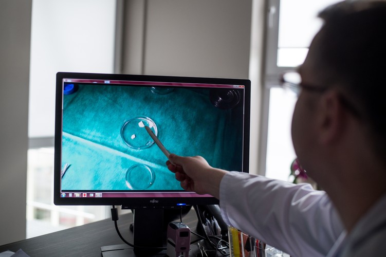 Pierwszy w Polsce zabieg wszczepienia tkanek jajnika