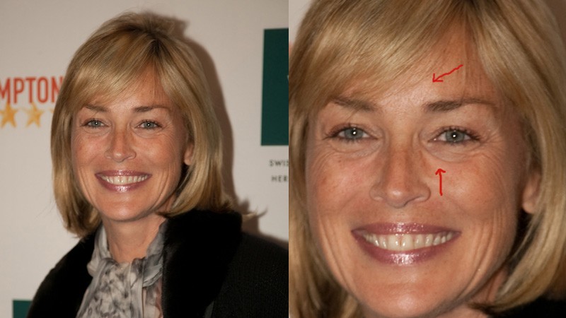 Sharon Stone wstrzykuje sobie BOTOKS