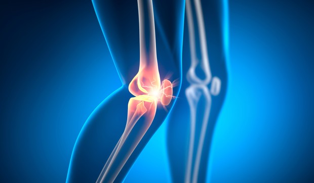 Zglobovi koji su zahvaćeni monoartritisom variraju u zavisnosti od uzroka