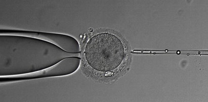 Radni zdecydowali. Poznań dopłaci do in vitro