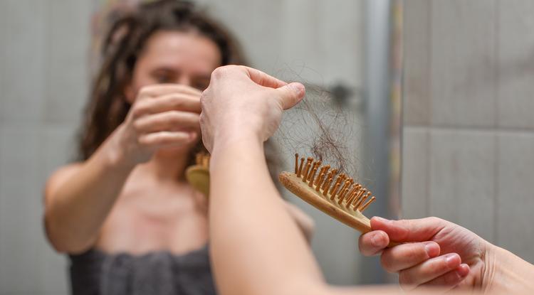 Itt a megoldás hajhullás ellen. Fotó: Getty Images