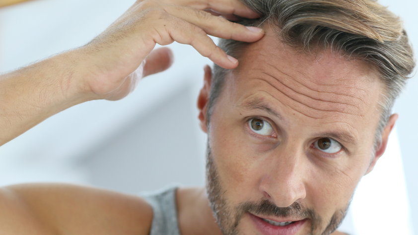 Jak zatrzymać łysienie? Sposoby na wypadanie włosów