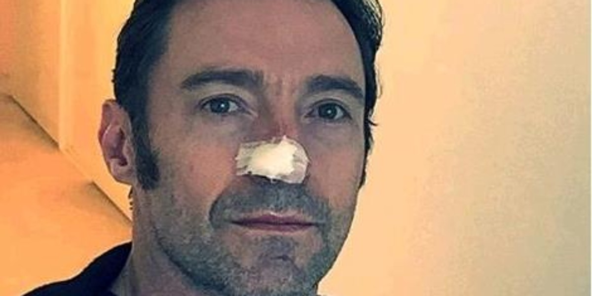 Hugh Jackman 