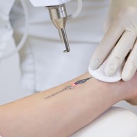 Tetováltatás véralvadásgátló mellett - az orvos elárulja, biztonságos-e