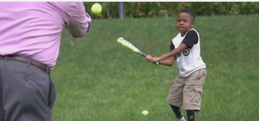 Zion Harvi sa transplantiranim šakama