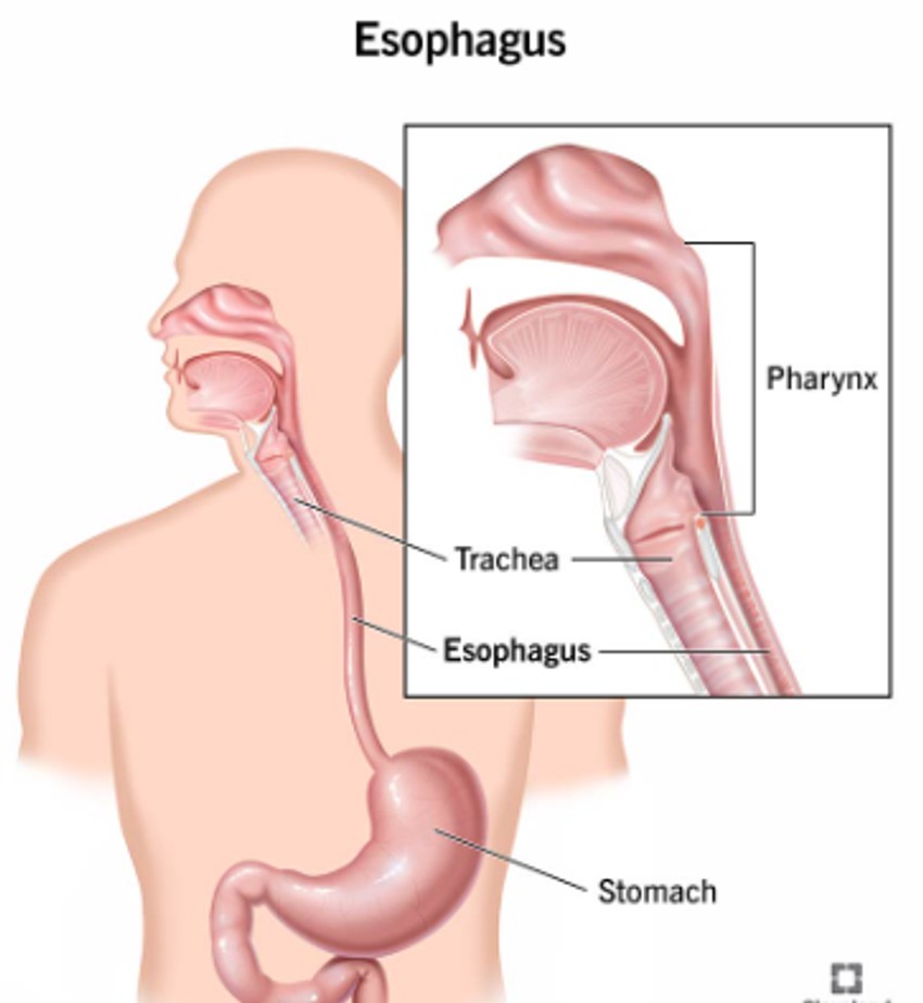 Kada je zid jednjaka pocepan, hrana, hemikalije i bakterije iz gastrointestinalnog trakta mogu da prodru u grudi