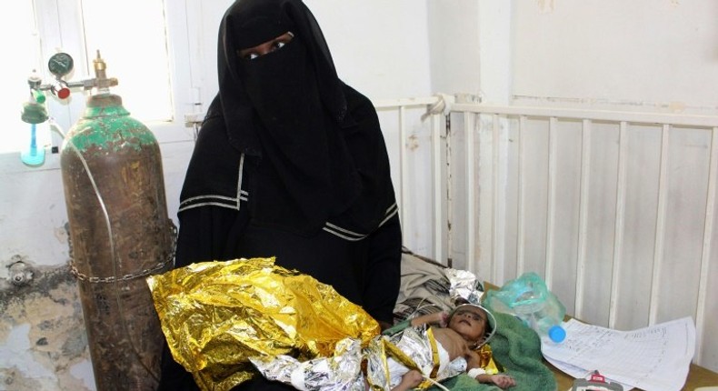 A newborn baby girl suffering from severe malnutrition at a hospital in Yemen's northwestern Hajjah province