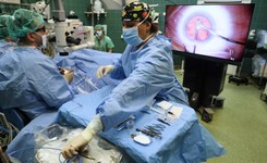 Usunięcie zaćmy w trójwymiarze. Zobacz, jak przebiegał zabieg