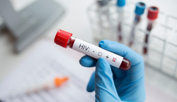 Potwierdzono pierwszy przypadek zakażenia HIV podczas zabiegu kosmetycznego