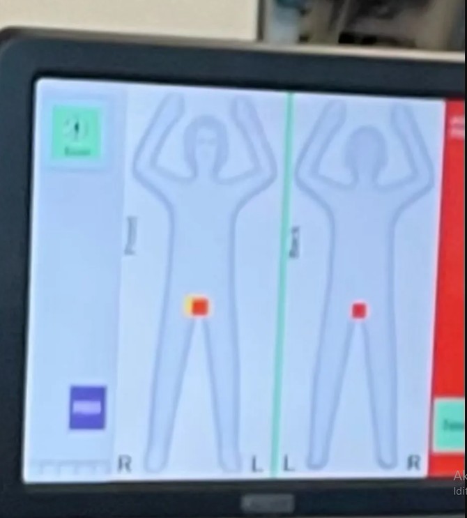 Poznatu Amerikanku zaustavili na aerodromu usled pregleda detektorom za metal, šok detalj napravio problem