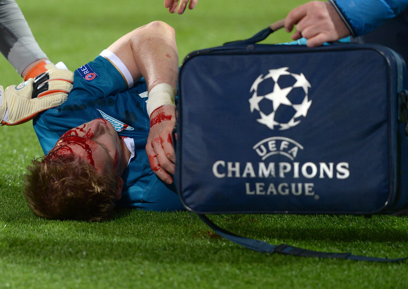 Lewandowski tuż przed końcem meczu przypadkowo "zahaczył" Hubocana kolanem w głowę.