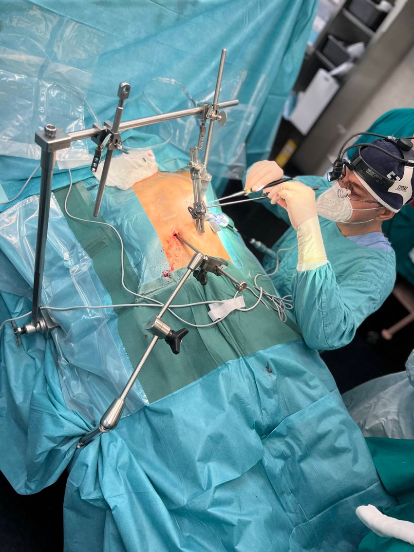 Petostruki bajpas ugrađen je kod pacijenta od 60 godina