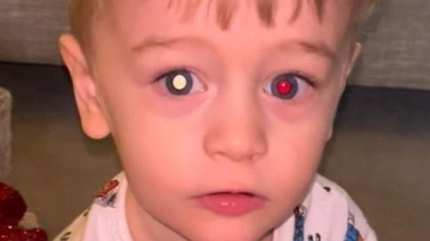 Lauru diagnóza synčeka zdrvila.