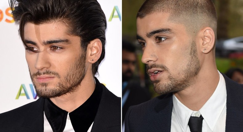 Zayn Malik's before and after