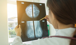 Rak piersi najczęstszym nowotworem kobiet - znaczenie profilaktyki. Mammografia może uratować życie