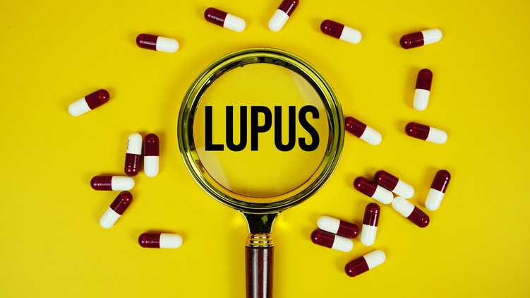 lupus szisztémás lupusz erythematosus SLE