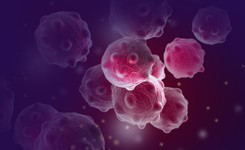 Co trzeci rak złośliwy może być nowotworem dietozależnym. Jak komponować posiłki?